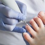 podiatry-doctor-treatment-feet-nails